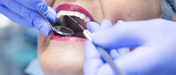 Best Emergency Root Canal Treatment in East Stroudsburg, PA